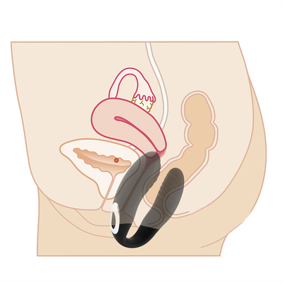 Vibrateur de massage vaginal à commande à distance Vibrateur de clitoris invisible